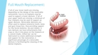 An Overview of Dental Imolants
