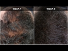 Hair Regrowth Experiment Week 8 Results