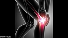 Hip Joint Replacement in Nagpur