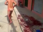 Man cuts off his own genitals