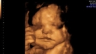 Amazing 4D baby scan  http://www.scan4d.co.uk/ call 08000...